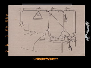 TRACTION
-Used in cases of fracture and spinal injuries to overcome muscle
contraction which would produce overriding and misalignment of
bones.
-Involves the aplication of regulated weight/s that will serve as pulling
force/s.
-Traction force is regulated between 0 and 200 pounds.
-Simple machines (pulley)
-Vectors
Cervical TractionLumbo-sacral TractionRussell Traction
 