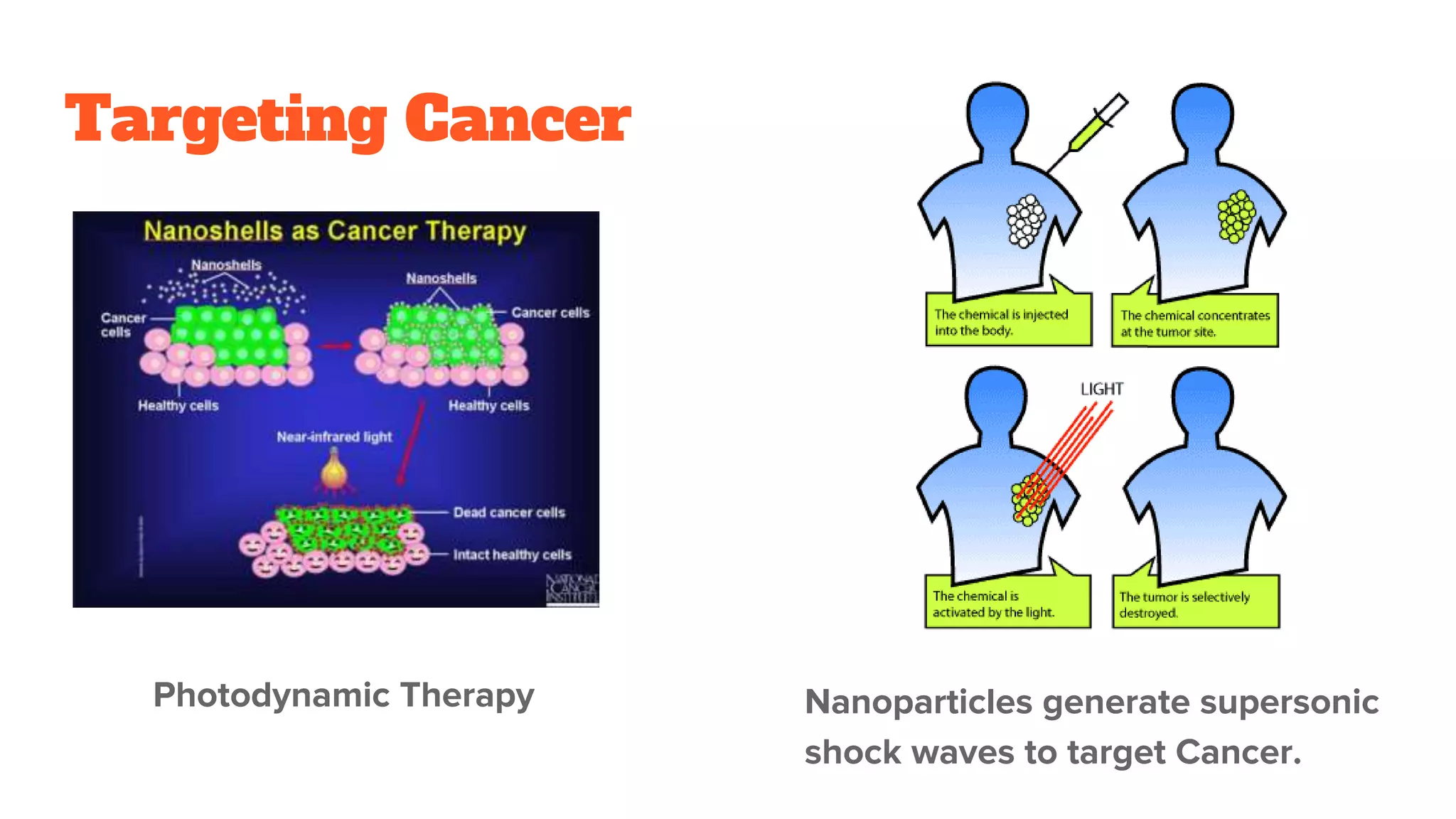 Targeting Cancer
Photodynamic Therapy Nanoparticles generate supersonic
shock waves to target Cancer.
 