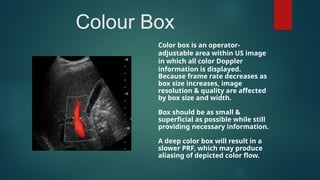 PHYSICS OF DOPPLER Doppler physics ultrasound | PPTX