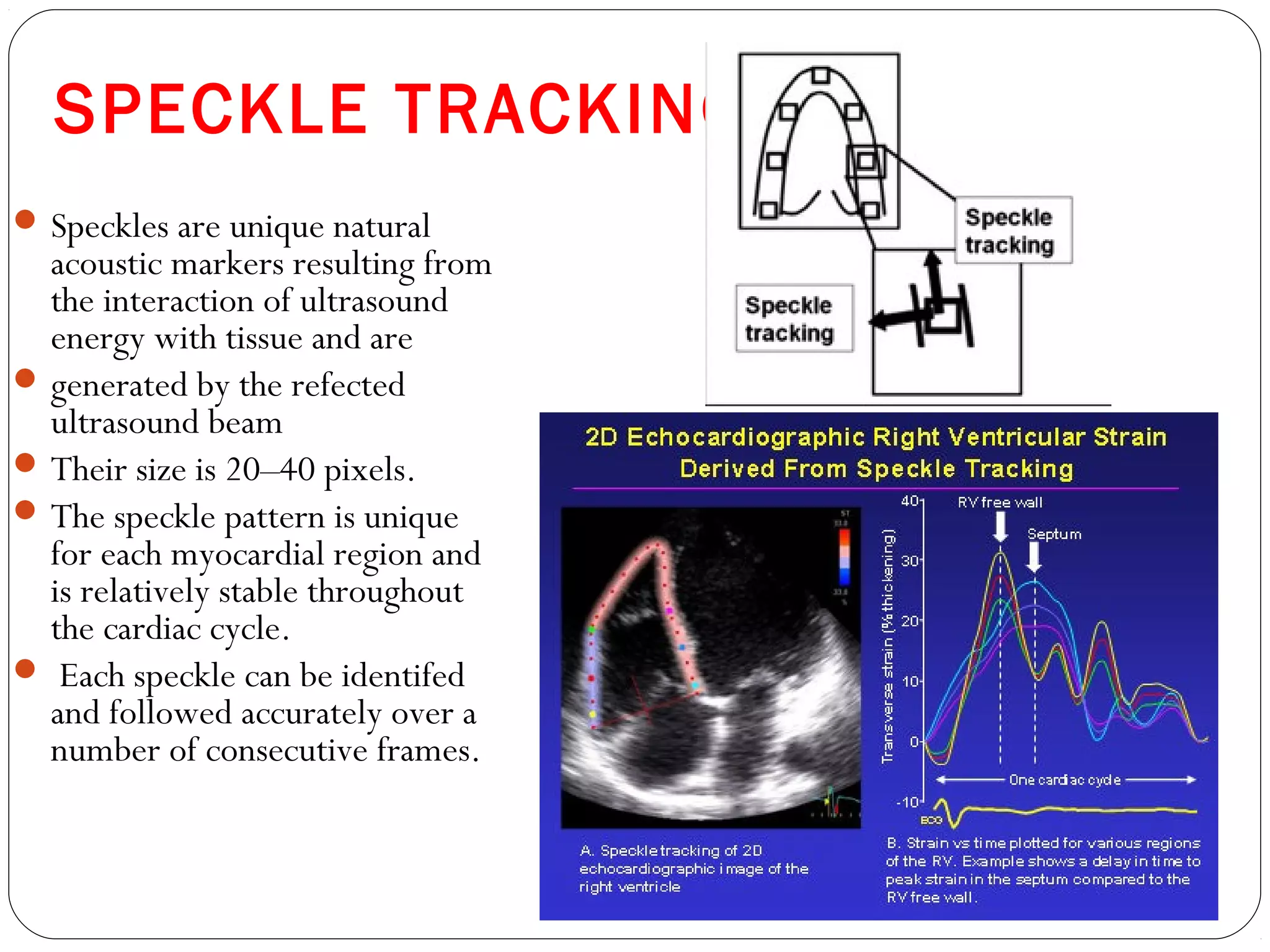SPECKLE TRACKING
Speckles are unique natural
acoustic markers resulting from
the interaction of ultrasound
energy with tissue and are
generated by the refected
ultrasound beam
Their size is 20–40 pixels.
The speckle pattern is unique
for each myocardial region and
is relatively stable throughout
the cardiac cycle.
 Each speckle can be identifed
and followed accurately over a
number of consecutive frames.
 