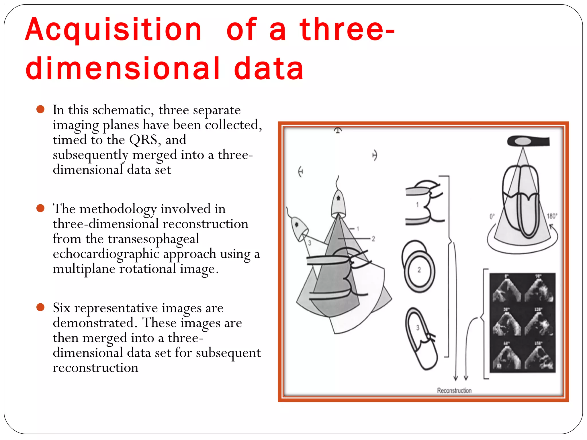 Acquisition of a three-
dimensional data
 In this schematic, three separate
imaging planes have been collected,
timed to the QRS, and
subsequently merged into a three-
dimensional data set
 The methodology involved in
three-dimensional reconstruction
from the transesophageal
echocardiographic approach using a
multiplane rotational image.
 Six representative images are
demonstrated. These images are
then merged into a three-
dimensional data set for subsequent
reconstruction
 
