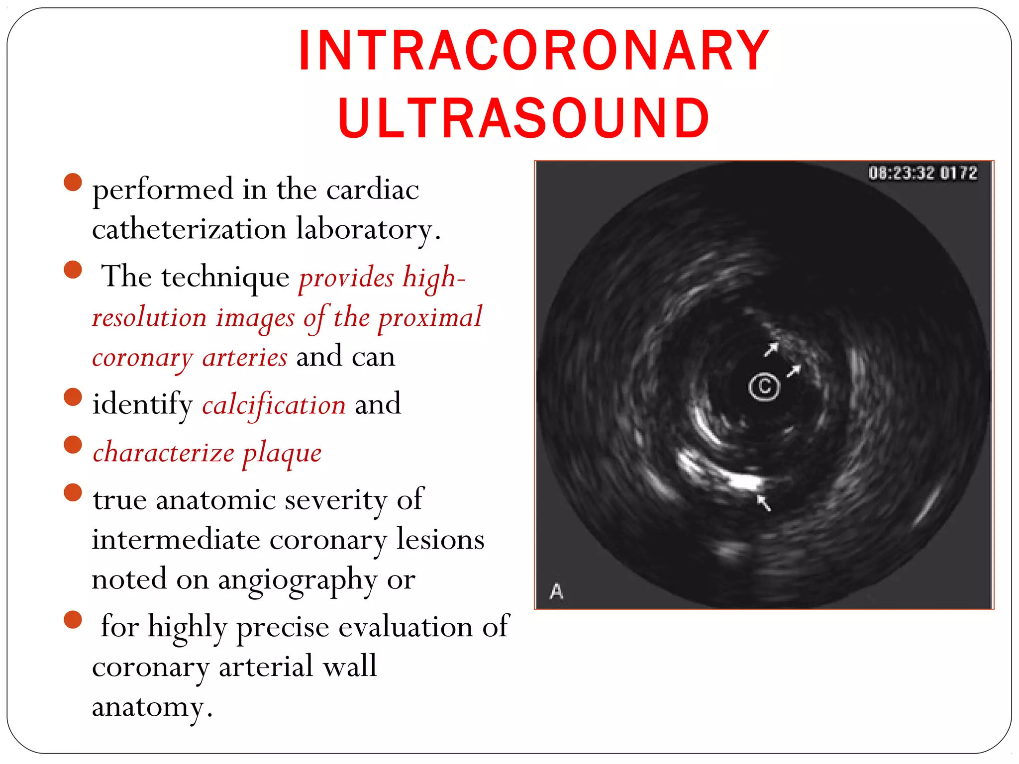 INTRACORONARY
ULTRASOUND
performed in the cardiac
catheterization laboratory.
 The technique provides high-
resolution images of the proximal
coronary arteries and can
identify calcification and
characterize plaque
true anatomic severity of
intermediate coronary lesions
noted on angiography or
 for highly precise evaluation of
coronary arterial wall
anatomy.
 