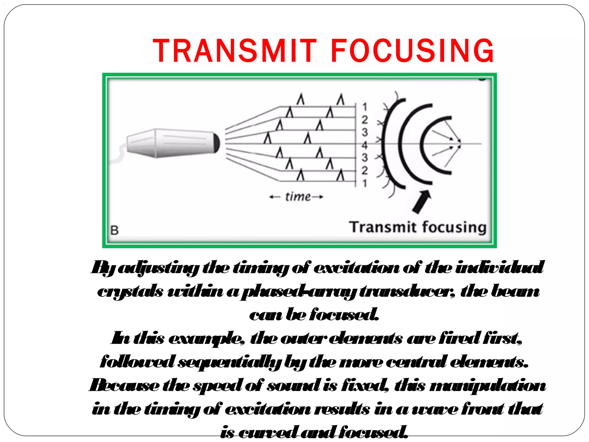 Byadjustingthetimingof excitationof theindividual
crystals withinaphased-arraytransducer, thebeam
canbefocused.
Inthis example, theouterelements arefiredfirst,
followedsequentiallybythemorecentralelements.
Becausethespeedof soundis fixed, this manipulation
inthetimingof excitationresults inawavefront that
is curvedandfocused.
TRANSMIT FOCUSING
 