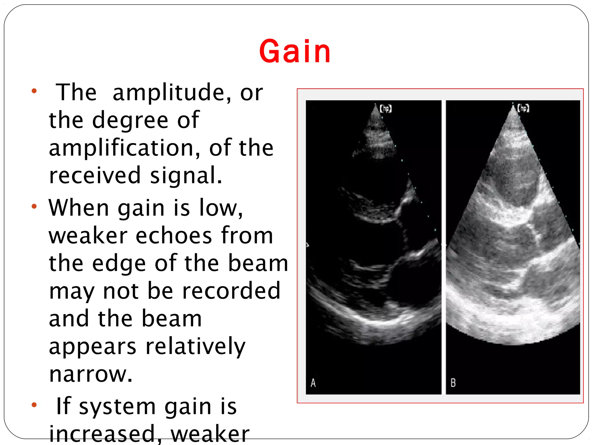Gain
• The amplitude, or
the degree of
amplification, of the
received signal.
• When gain is low,
weaker echoes from
the edge of the beam
may not be recorded
and the beam
appears relatively
narrow.
• If system gain is
increased, weaker
 