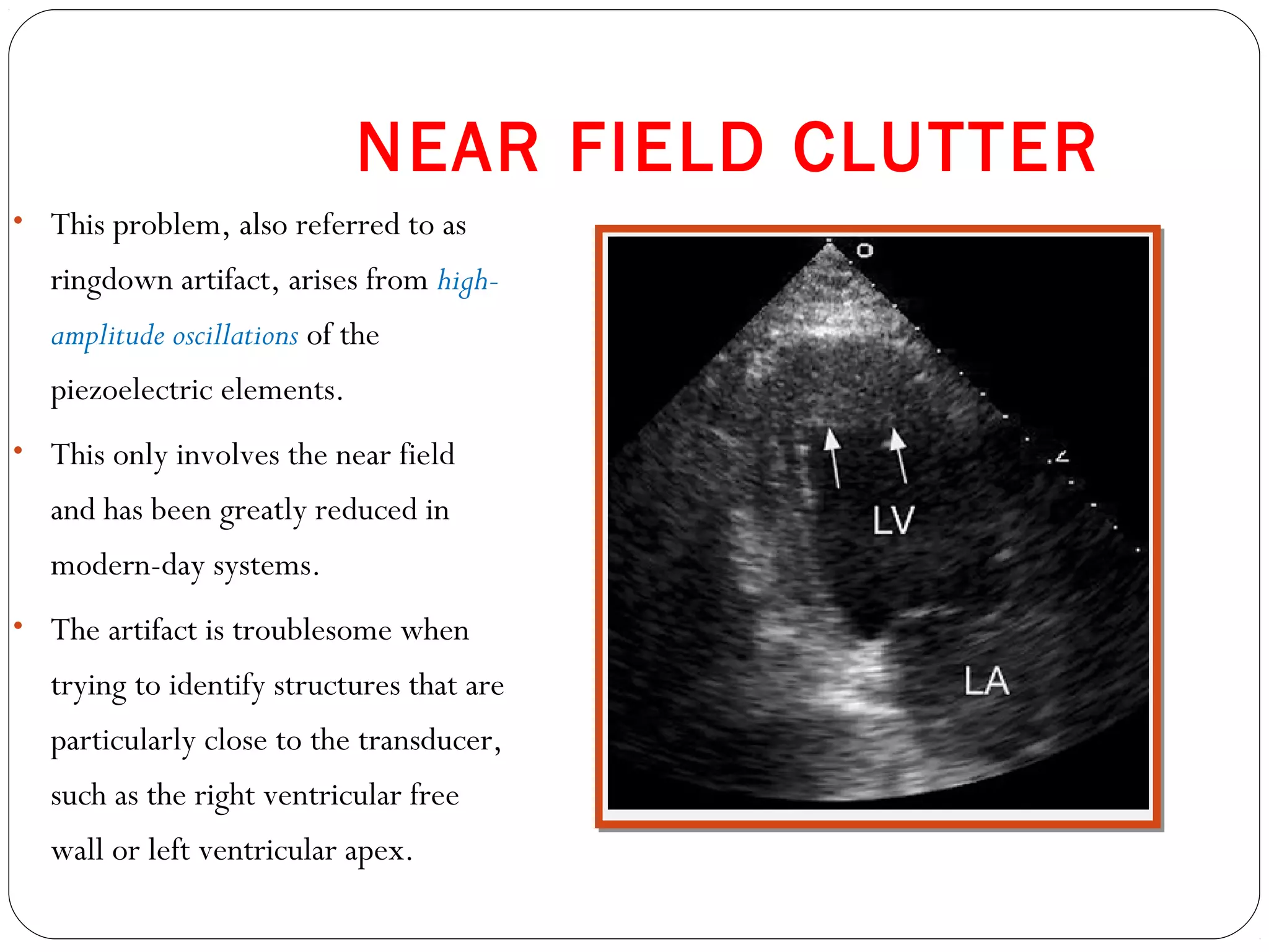 NEAR FIELD CLUTTER
• This problem, also referred to as
ringdown artifact, arises from high-
amplitude oscillations of the
piezoelectric elements.
• This only involves the near field
and has been greatly reduced in
modern-day systems.
• The artifact is troublesome when
trying to identify structures that are
particularly close to the transducer,
such as the right ventricular free
wall or left ventricular apex.
 