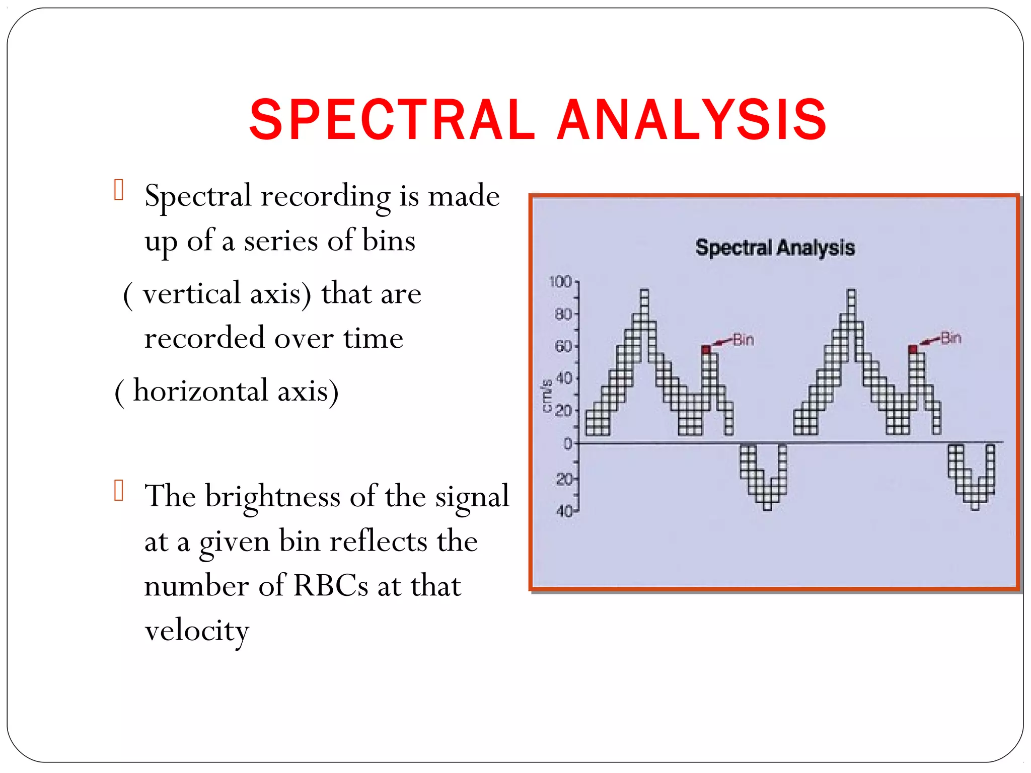 SPECTRAL ANALYSIS
 Spectral recording is made
up of a series of bins
( vertical axis) that are
recorded over time
( horizontal axis)
 The brightness of the signal
at a given bin reflects the
number of RBCs at that
velocity
 