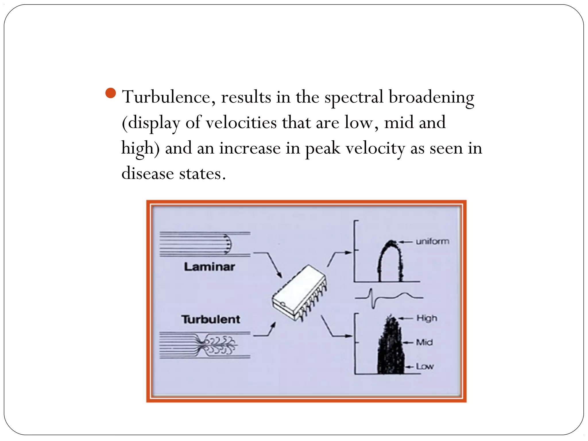 Turbulence, results in the spectral broadening
(display of velocities that are low, mid and
high) and an increase in peak velocity as seen in
disease states.
 