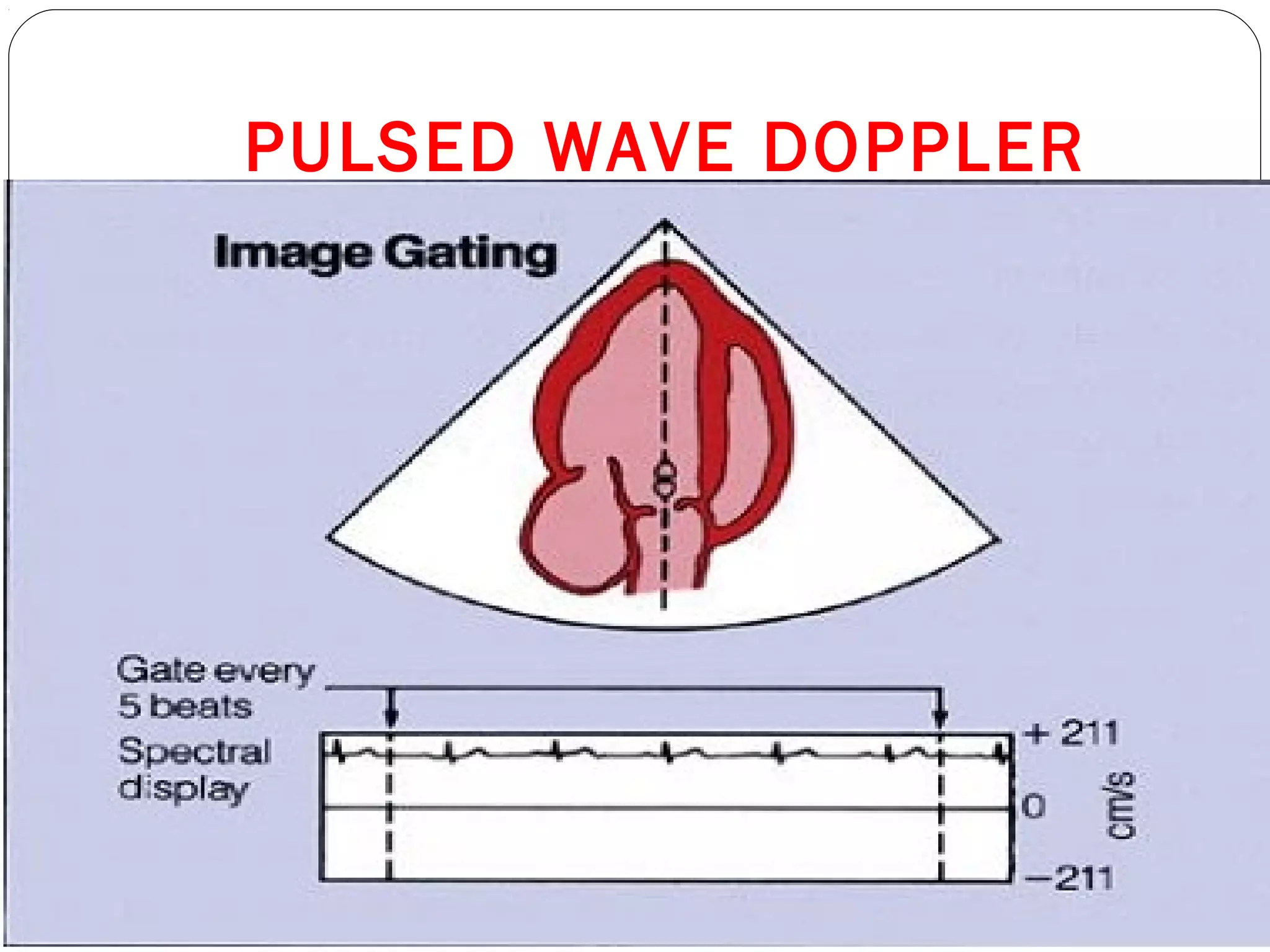 PULSED WAVE DOPPLER
 