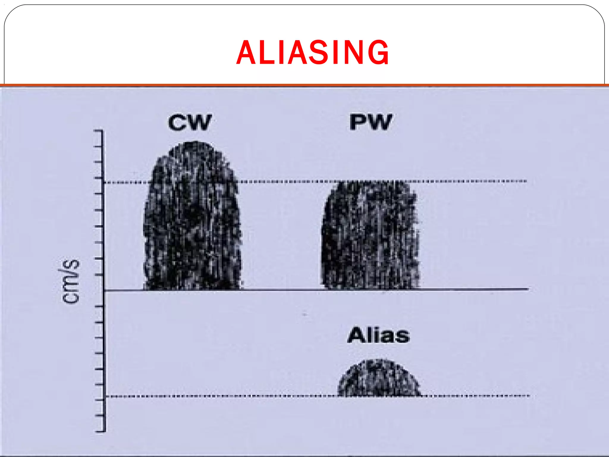 ALIASING
 