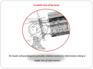TELEVISION TECHNOLOGY
• Modern echocardiographic instruments -- images are displayed
on a television screen using the conc...