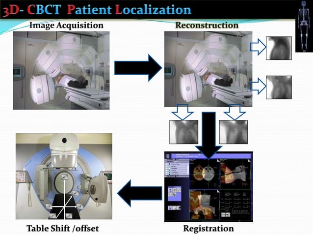Intensity modulated radiation therapy and Image guided radiation ...