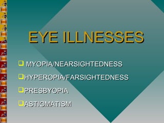 EYE ILLNESSESEYE ILLNESSES
 MYOPIA/NEARSIGHTEDNESSMYOPIA/NEARSIGHTEDNESS
HYPEROPIA/FARSIGHTEDNESSHYPEROPIA/FARSIGHTEDNESS
PRESBYOPIAPRESBYOPIA
ASTIGMATISMASTIGMATISM
 