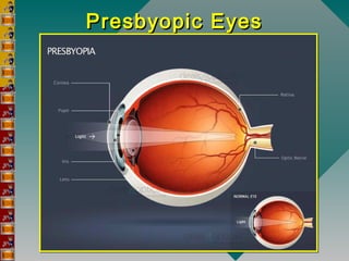 Presbyopic EyesPresbyopic Eyes
 