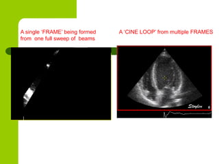 Physics of ultrasound and echocardiography | PPTX
