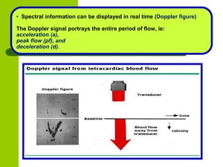 Doppler Velocity And Pressure Gradient
 Doppler echo can estimate the pressure difference across a stenotic
valve or betw...