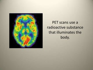 PET scans use a radioactive substance that illuminates the body. 