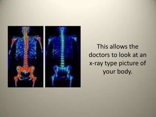 This allows the doctors to look at an x-ray type picture of your body. 