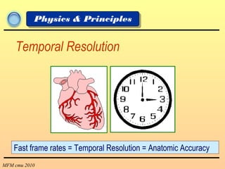MFM cmu 2010
Physics & Principles
Temporal Resolution
Fast frame rates = Temporal Resolution = Anatomic Accuracy
 