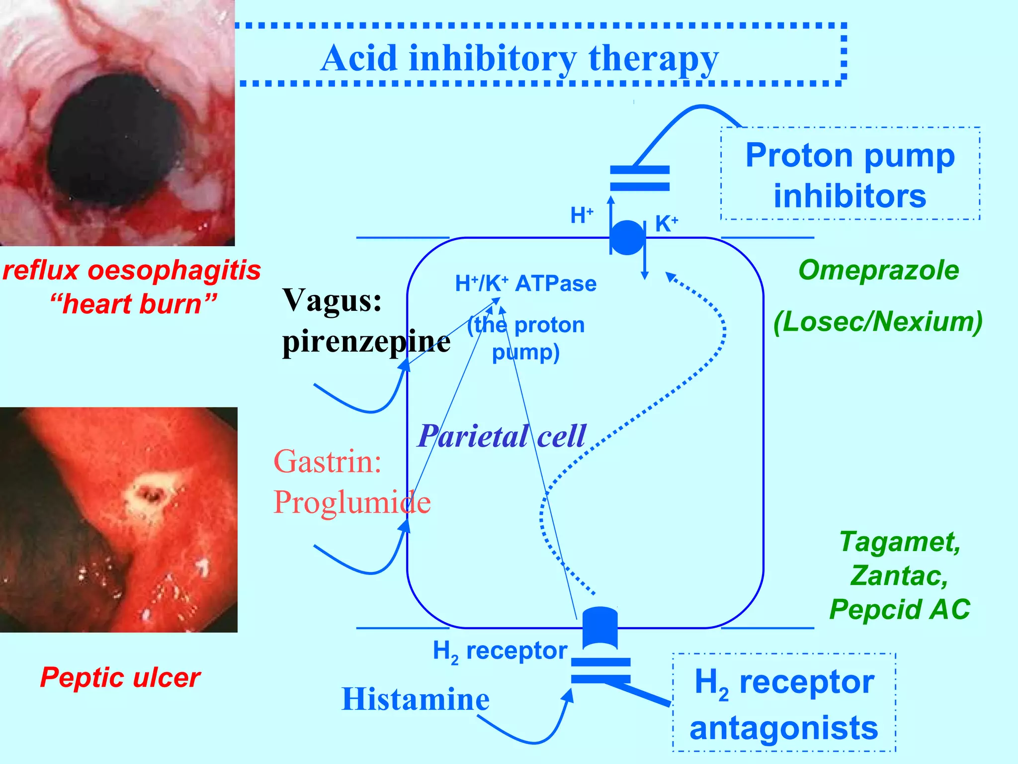 Acid inhibitory therapy
H2 receptor
antagonists
Histamine
Parietal cell
H2 receptor
H+
/K+
ATPase
(the proton
pump)
H+
K+
Proton pump
inhibitors
Peptic ulcer
reflux oesophagitis
“heart burn”
Tagamet,
Zantac,
Pepcid AC
Omeprazole
(Losec/Nexium)
Gastrin:
Proglumide
Vagus:
pirenzepine
 