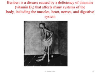 Beriberi is a disease caused by a deficiency of thiamine
     (vitamin B1) that affects many systems of the
body, including the muscles, heart, nerves, and digestive
                         system




                         Dr. Siham Gritly              22
 
