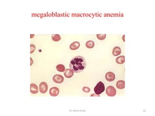 megaloblastic macrocytic anemia




            Dr. Siham Gritly      52
 