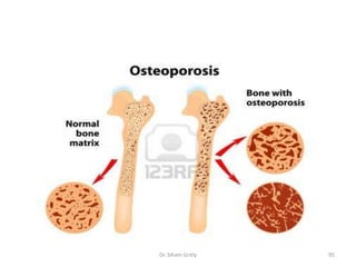 Dr. Siham Gritly   95
 