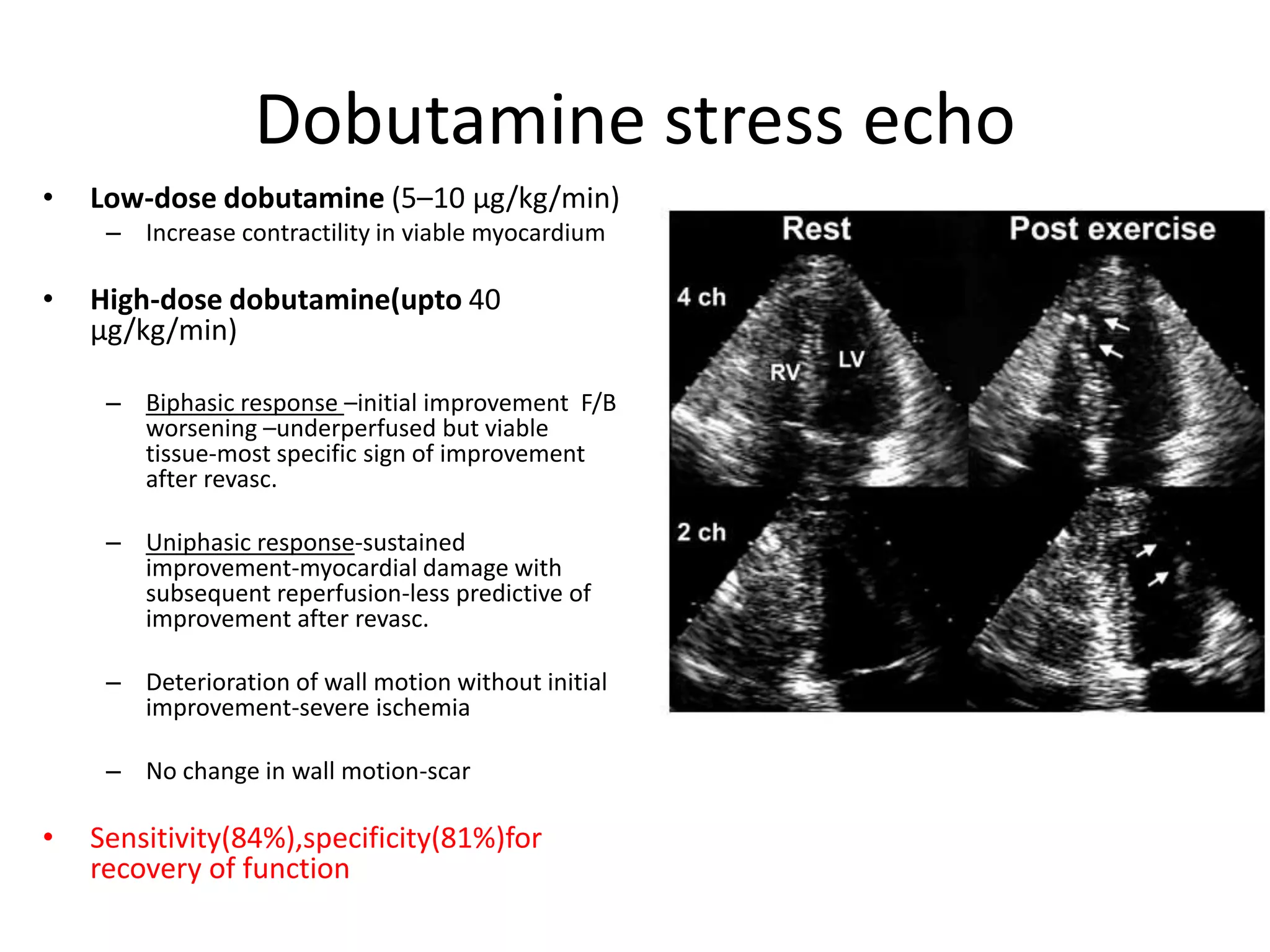 Dobutamine stress echo
• Low-dose dobutamine (5–10 μg/kg/min)
– Increase contractility in viable myocardium
• High-dose dobutamine(upto 40
μg/kg/min)
– Biphasic response –initial improvement F/B
worsening –underperfused but viable
tissue-most specific sign of improvement
after revasc.
– Uniphasic response-sustained
improvement-myocardial damage with
subsequent reperfusion-less predictive of
improvement after revasc.
– Deterioration of wall motion without initial
improvement-severe ischemia
– No change in wall motion-scar
• Sensitivity(84%),specificity(81%)for
recovery of function
 