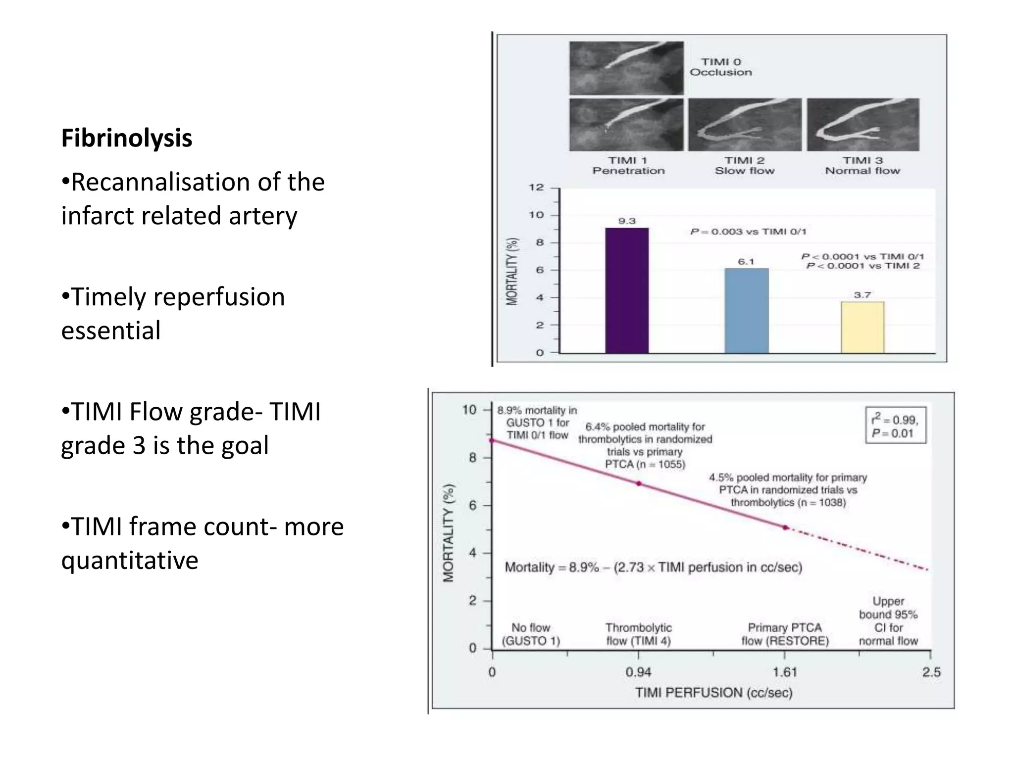 Fibrinolysis
•Recannalisation of the
infarct related artery
•Timely reperfusion
essential
•TIMI Flow grade- TIMI
grade 3 is the goal
•TIMI frame count- more
quantitative
 