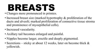 BREASTS
• Changes more pronounced in primies.
• Increased breast size (marked hypertrophy & proliferation of the
ducts and alveoli; marked proliferation of connective tissue stroma
and prominence of myoepithelial cells).
• Increased vascularity.
• Axillary tail becomes enlarged and painful.
• Nipples become larger, erectile and deeply pigmented.
• Secretions – sticky at about 12 weeks, later on become thick &
yellowish.
 