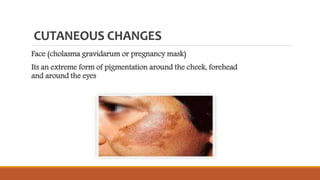 CUTANEOUS CHANGES
Face (cholasma gravidarum or pregnancy mask)
Its an extreme form of pigmentation around the cheek, forehead
and around the eyes
 