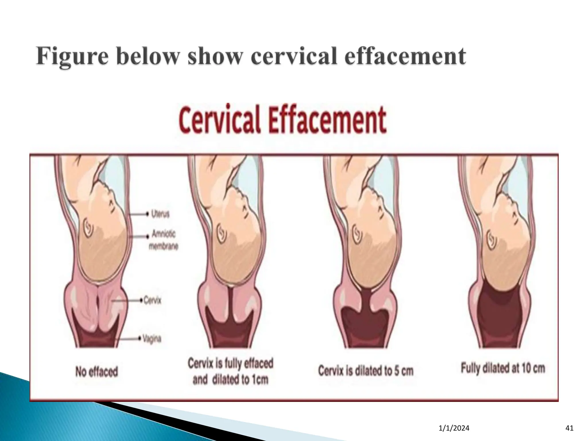 PHYSIOLOGICAL CHANGES IN FIRST STAGE OF LABOUR.ppt