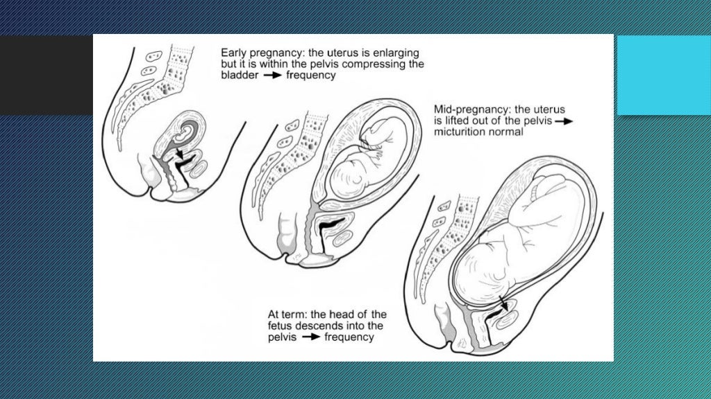 Physiological changes in pregnancy