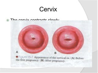 Cervix
 The cervix contracts slowly.
 External os: admits two fingers for a few days
but by the end of first week, narrow down to
admit the tip of finger only. It never returns back
to the nulliparous state, usually remains slightly
open and appear slitlike or stellate (star shaped).
 Internal os: Internal os closes as before.
 