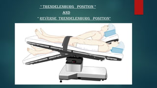 * Trendelenburg position *
* Reverse Trendelenburg position*
AND
 