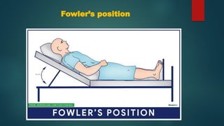 Fowler’s position
 