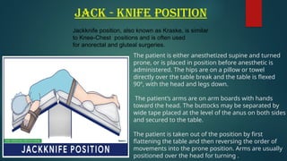 Jack - knife position
The patient is either anesthetized supine and turned
prone, or is placed in position before anesthetic is
administered. The hips are on a pillow or towel
directly over the table break and the table is flexed
90º, with the head and legs down.
The patient’s arms are on arm boards with hands
toward the head. The buttocks may be separated by
wide tape placed at the level of the anus on both sides
and secured to the table.
The patient is taken out of the position by first
flattening the table and then reversing the order of
movements into the prone position. Arms are usually
positioned over the head for turning .
Jackknife position, also known as Kraske, is similar
to Knee-Chest positions and is often used
for anorectal and gluteal surgeries.
 