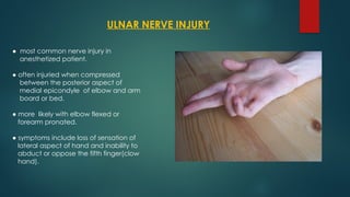 ULNAR NERVE INJURY
● most common nerve injury in
anesthetized patient.
● often injuried when compressed
between the posterior aspect of
medial epicondyle of elbow and arm
board or bed.
● more likely with elbow flexed or
forearm pronated.
● symptoms include loss of sensation of
lateral aspect of hand and inability to
abduct or oppose the fifth finger(clow
hand).
 