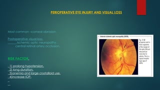 PERIOPERATIVE EYE INJURY AND VISUAL LOSS
Most common –corneal abrasion.
Postoperative visual loss.
ischemic optic neuropathy.
central retinal artery occlusion.
RISK FACTOR.
1) prolong hypotension.
2) long duration.
3)anemia and large crystalloid use.
4)increase IOP.
 
