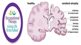Physiological Changes of Aging & Occupational Therapy