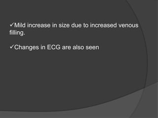 Mild increase in size due to increased venous
filling.
Changes in ECG are also seen
 