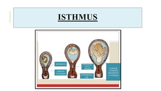 ISTHMUS
 