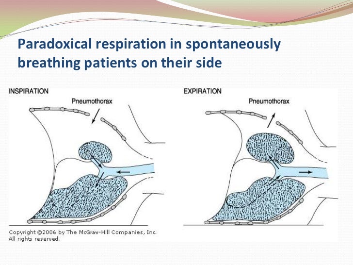 Physiological considerations and patient positioning during anesthesi…