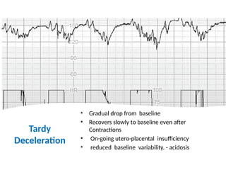 physiological CTG.pptx latest updates 2024 | PPTX