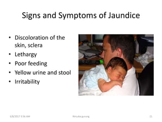 Signs and Symptoms of Jaundice
• Discoloration of the
skin, sclera
• Lethargy
• Poor feeding
• Yellow urine and stool
• Irritability
3/8/2017 3:56 AM 21Nirsuba gurung
 