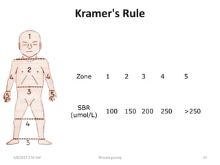 Kramer's Rule
Zone 1 2 3 4 5
SBR
(umol/L)
100 150 200 250 >250
3/8/2017 3:56 AM 24Nirsuba gurung
 