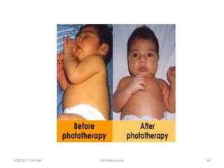 3/8/2017 3:56 AM Nirsuba gurung 40
 