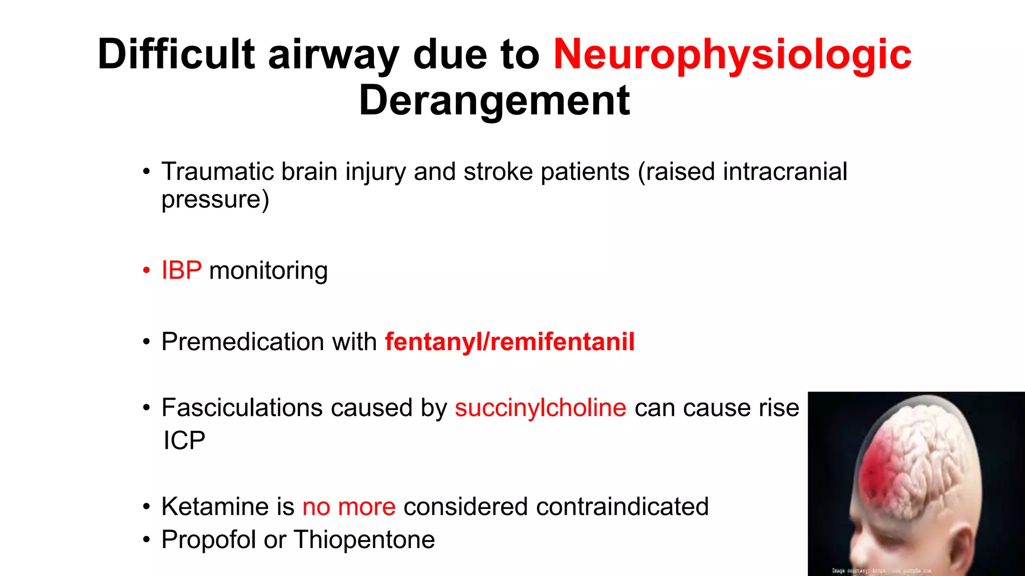 Difficult airway due to Neurophysiologic
Derangement
• Traumatic brain injury and stroke patients (raised intracranial
pressure)
• IBP monitoring
• Premedication with fentanyl/remifentanil
• Fasciculations caused by succinylcholine can cause rise
ICP
• Ketamine is no more considered contraindicated
• Propofol or Thiopentone
 
