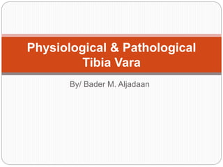 By/ Bader M. Aljadaan
Physiological & Pathological
Tibia Vara
 