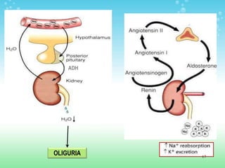 OLIGURIA
ADH
17
 