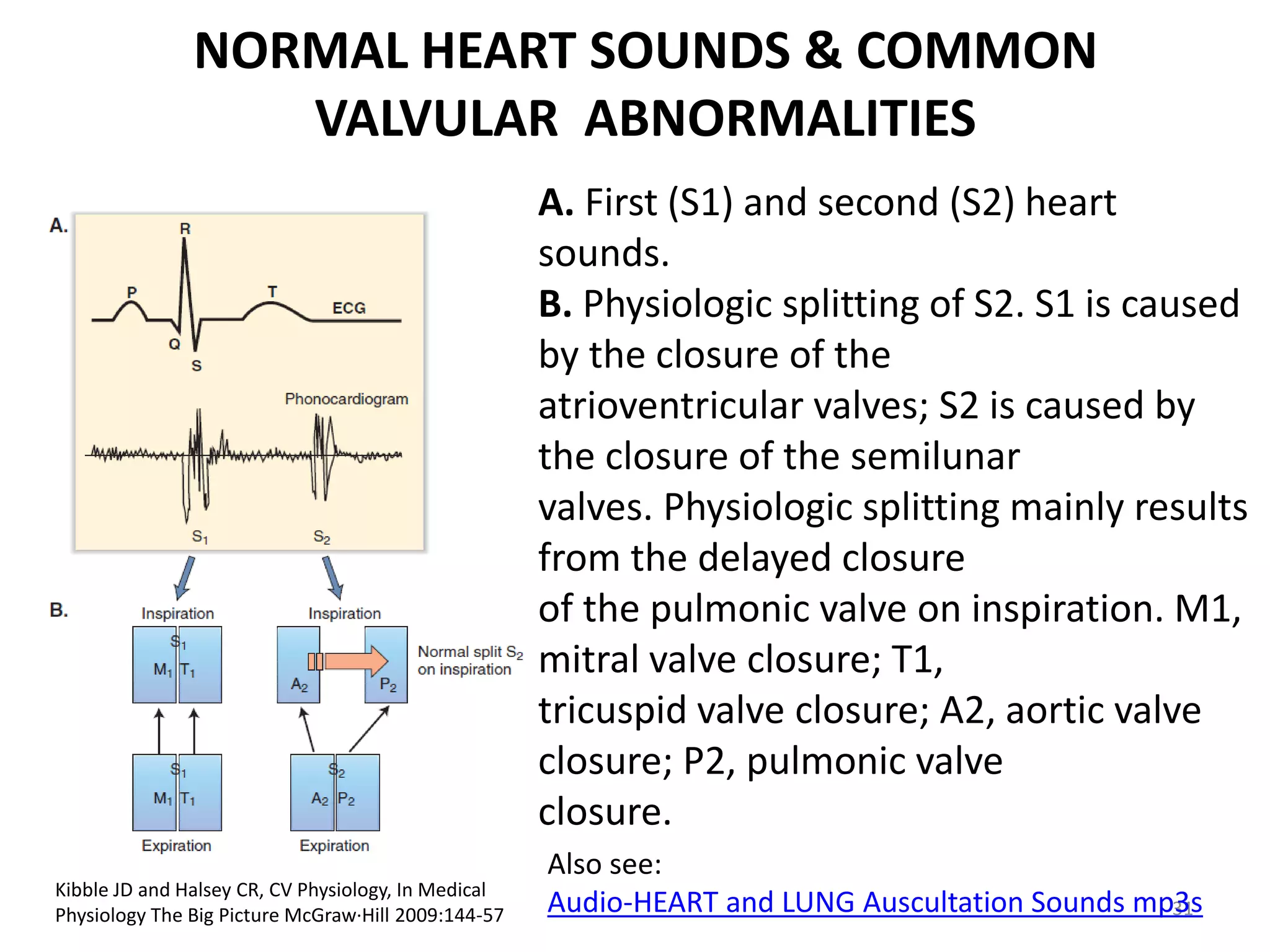 NORMAL HEART SOUNDS & COMMON
VALVULAR ABNORMALITIES
A. First (S1) and second (S2) heart
sounds.
B. Physiologic splitting of S2. S1 is caused
by the closure of the
atrioventricular valves; S2 is caused by
the closure of the semilunar
valves. Physiologic splitting mainly results
from the delayed closure
of the pulmonic valve on inspiration. M1,
mitral valve closure; T1,
tricuspid valve closure; A2, aortic valve
closure; P2, pulmonic valve
closure.
Kibble JD and Halsey CR, CV Physiology, In Medical
Physiology The Big Picture McGraw·Hill 2009:144-57

Also see:
Audio-HEART and LUNG Auscultation Sounds mp3s
31

 